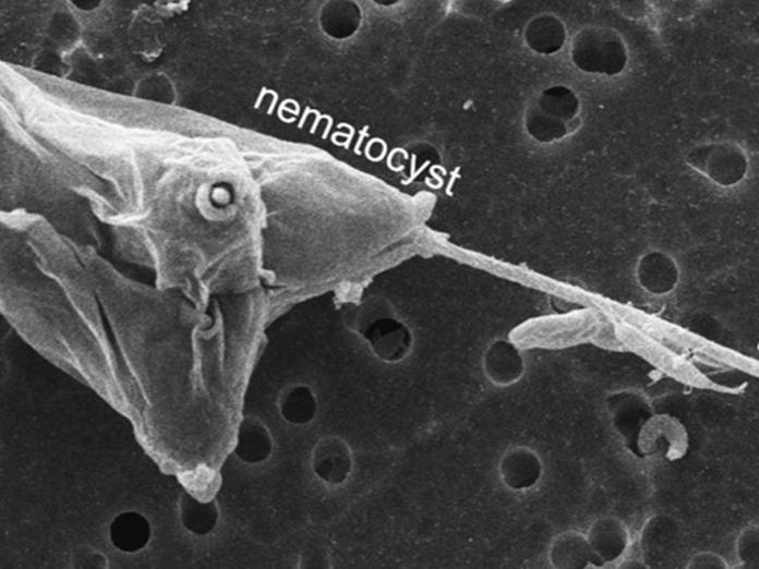 Microscope image of a nematocyst