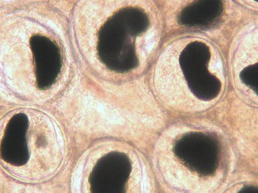 Cells with black spots